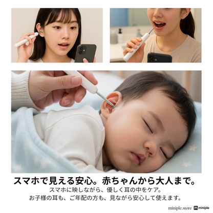 イヤースコープ