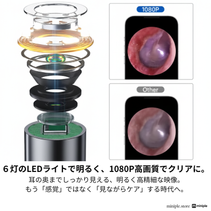 イヤースコープ